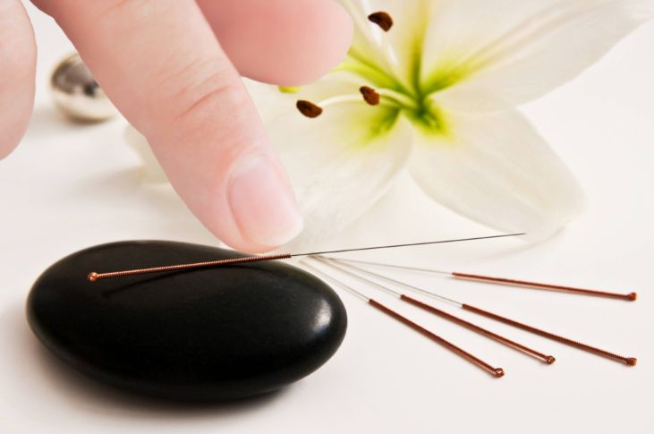 Accupuncture
